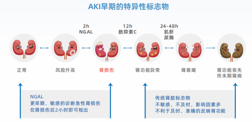 NGAL：中文名记不住，要记住这些临床价值